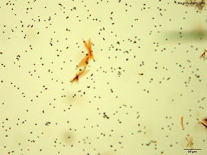 crystal thumbnail 8
